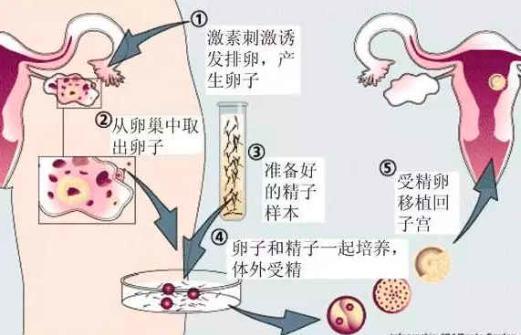 试管代怀孕母_试管代孕母亲的故事