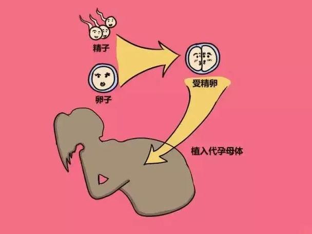 代生孩子有吗_代生孩子有吗？选择代孕的利与弊