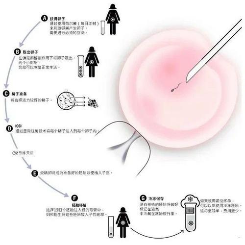 国外做试管代怀有哪些【国外试管代怀：全面解析代孕流程】